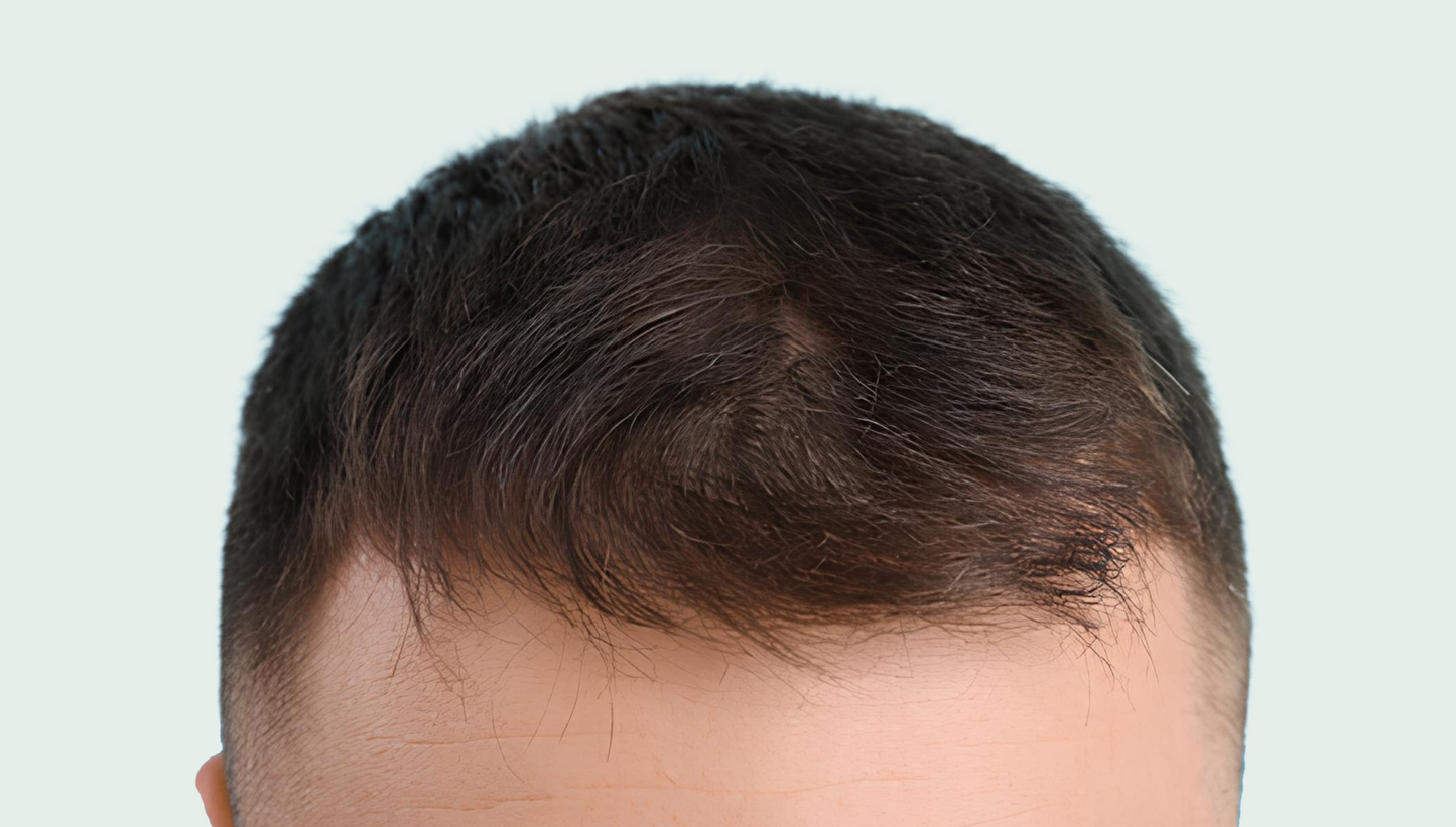 Set van 3 haarverzorgingsproducten 15% korting